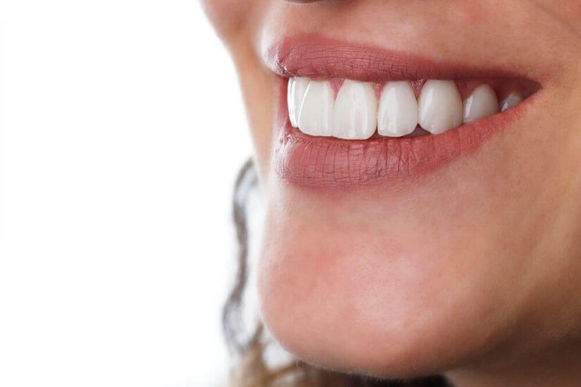 Zirkonium Porzellan Behandlung Bodrum Zahnarzt