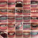 Bodrum Diş Hekimi Senem Aslı Ekşioğlu Ortodonti