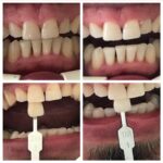 Bodrum Diş Hekimi Senem Aslı Ekşioğlu Ortodonti